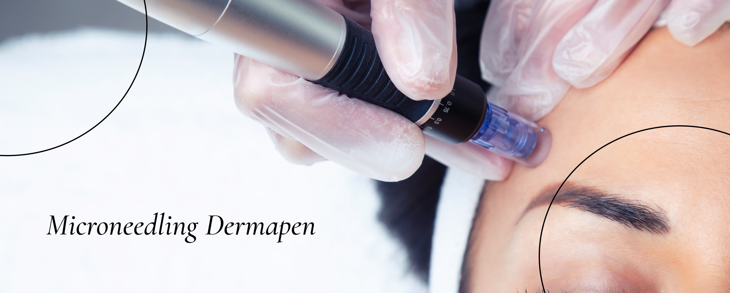 Microneedling Dermapen